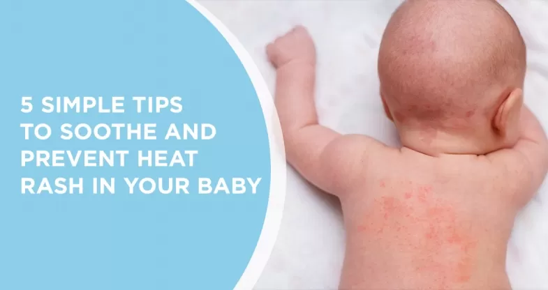 Home Remedies for Baby Rash: Natural Solutions for Your Little