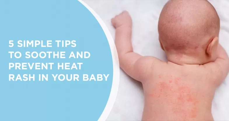 Baby Heat Rash: Types, Symptoms And Treatment