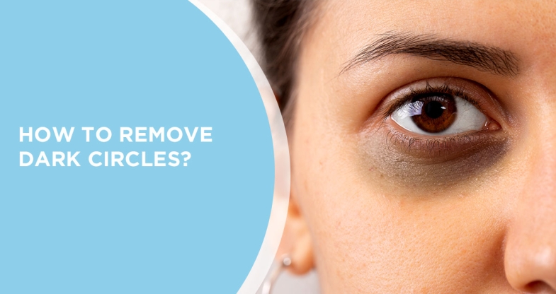 How to Remove Dark Circles at Home Naturally?