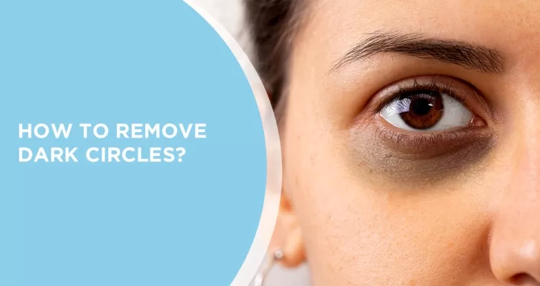 Home remedies to remove dark circles QUICKLY and NATURALLY! 