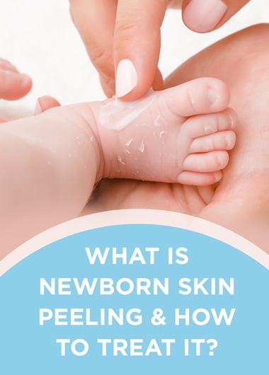 What is Newborn Skin Peeling and How to Treat it?