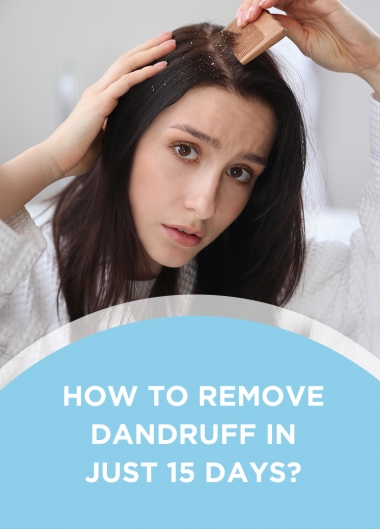 How to Remove Dandruff in Just 15 Days?