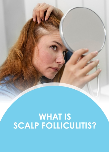 What is Scalp Folliculitis